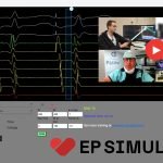 EP-Simulator: il simulatore online di Elettrofisiologia 